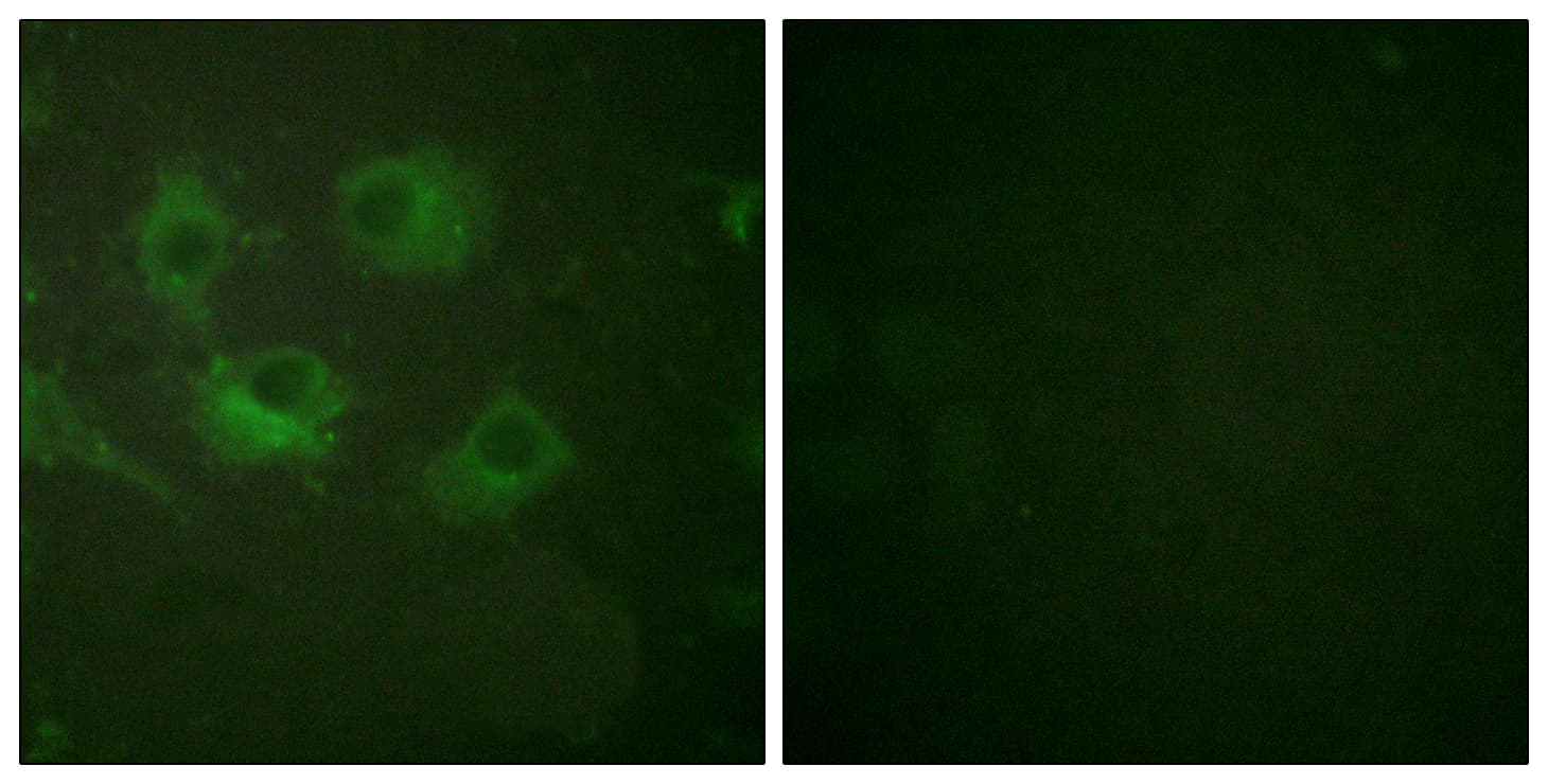 IHC-plus™ Polyclonal Rabbit anti-Human CLDN3 / Claudin 3 Antibody (aa171-220, IHC, IF, WB)
