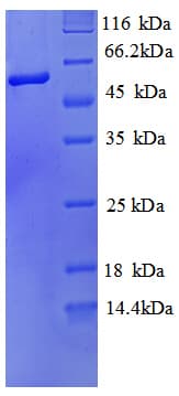 Mouse ALPL / Alkaline Phosphatase Protein (Recombinant His)