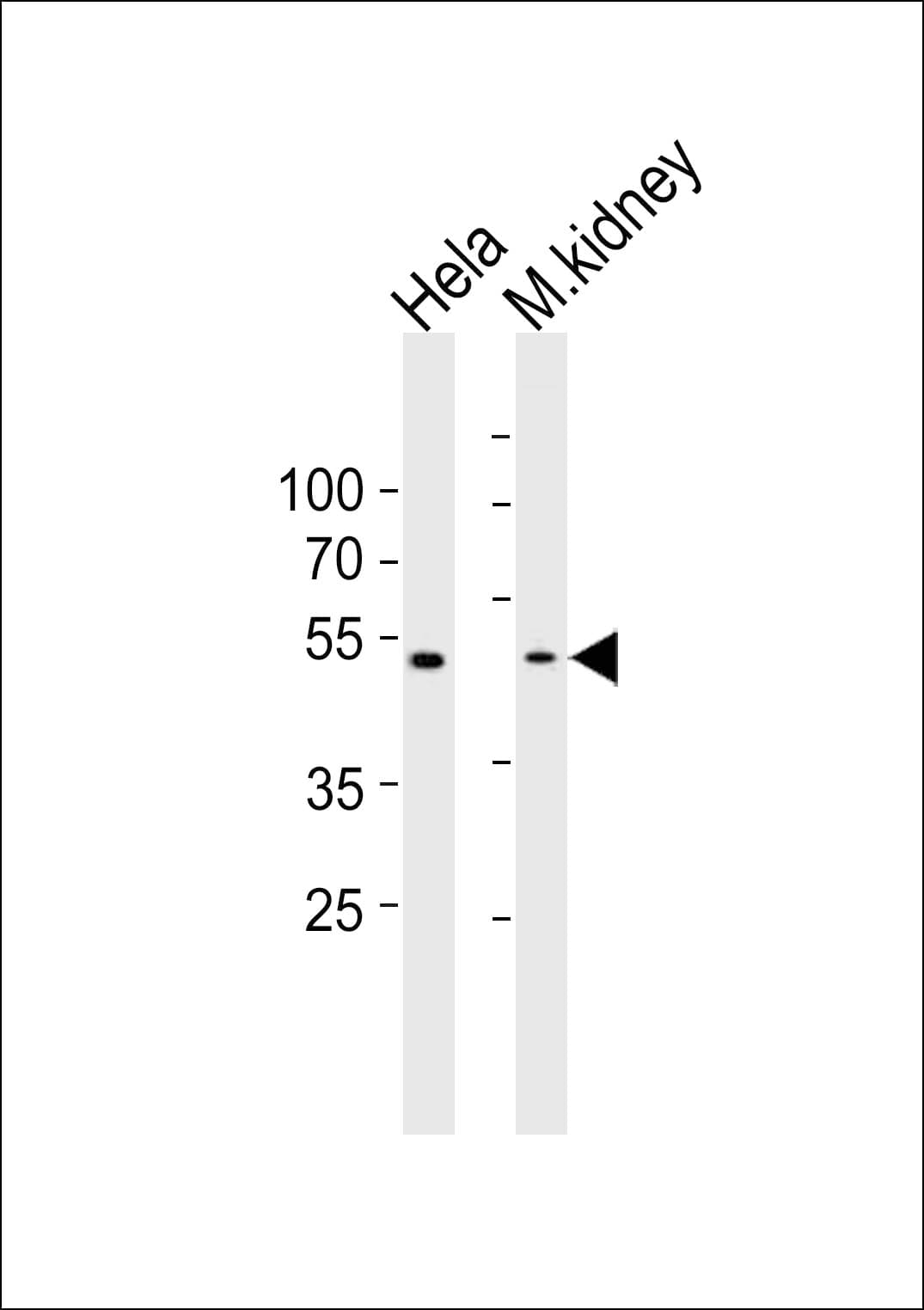 WWTR1 / TAZ Antibody (aa296-330)