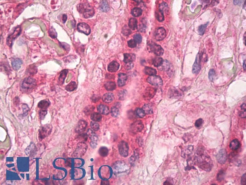 IHC-plus™ TGM1 / Transglutaminase Antibody (clone 6.4_2G6)