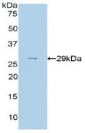 CFH / Complement Factor H Antibody (aa975-1217)