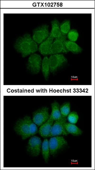KRT2 / CK2 / Cytokeratin 2 Antibody (aa143-529)
