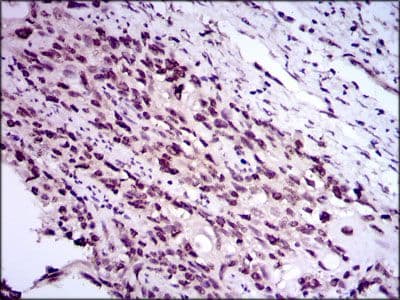 E2F1 Antibody (Amino Acid: 69-223, clone 8G9)