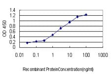IHC-plus™ RBBP6 Antibody (clone 5A11)