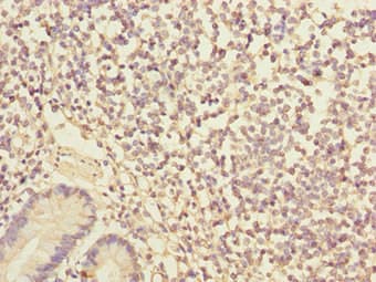 IKBIP Antibody