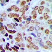 CBX3 / HP1 Gamma Antibody (phospho-Ser93)