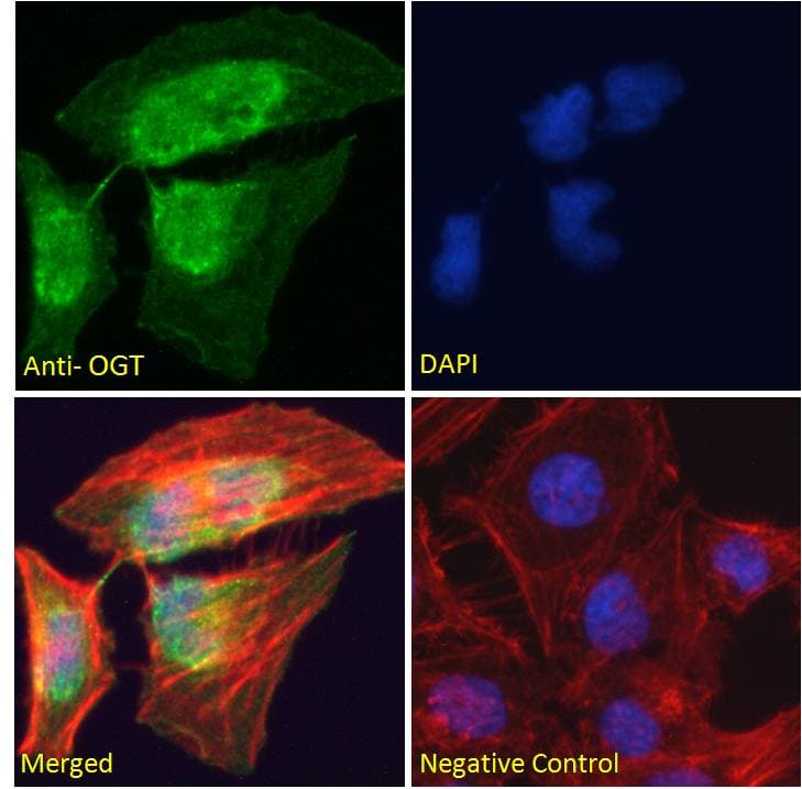 IHC-plus™ OGT / O-GLCNAC Antibody (aa543-555)