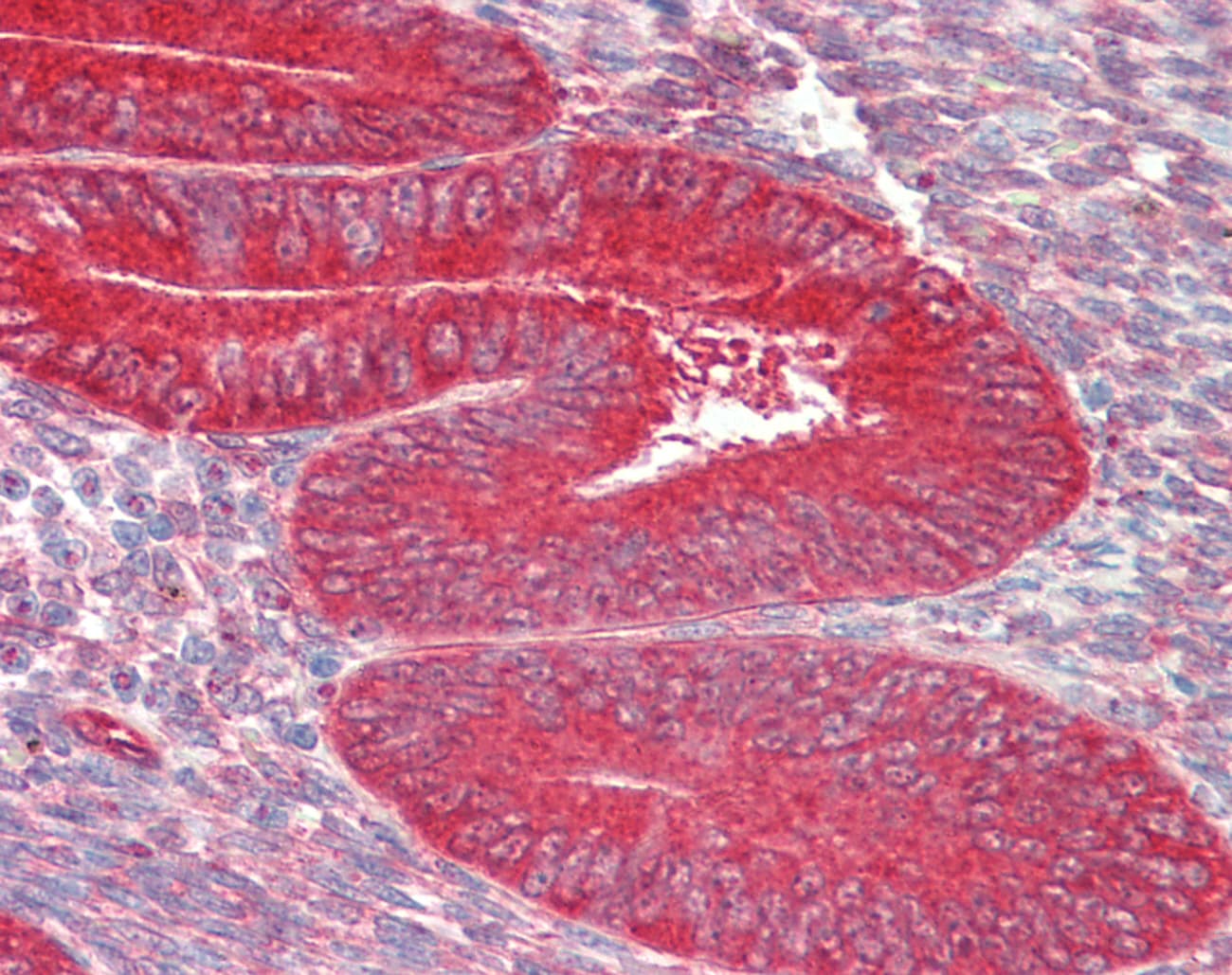 ZFP36L1 Antibody (aa46-95)