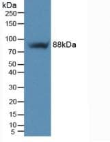 ITGB5 / Integrin Beta 5 Antibody (aa137-378)