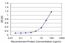 CDC42BPB / MRCKB Antibody (clone 6G3)