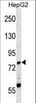 ZAP70 Antibody (aa530-558)