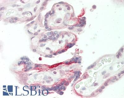 IHC-plus™ VWA9 / C15orf44 Antibody (aa100-150)