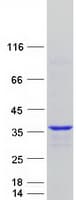 Human CCNY / Cyclin Y Protein (Recombinant Myc-DDK (Flag))