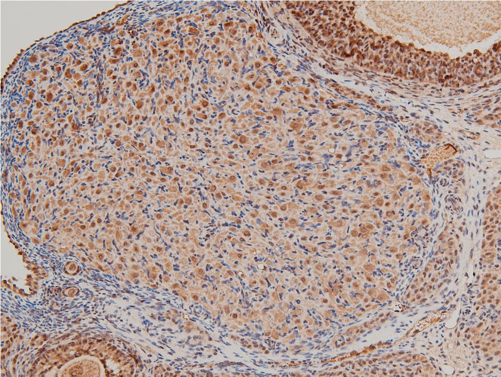 LIMK1 / LIMK Antibody (phospho-Thr508)