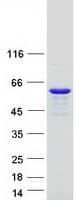 Human RILP Protein (Recombinant Myc-DDK (Flag))
