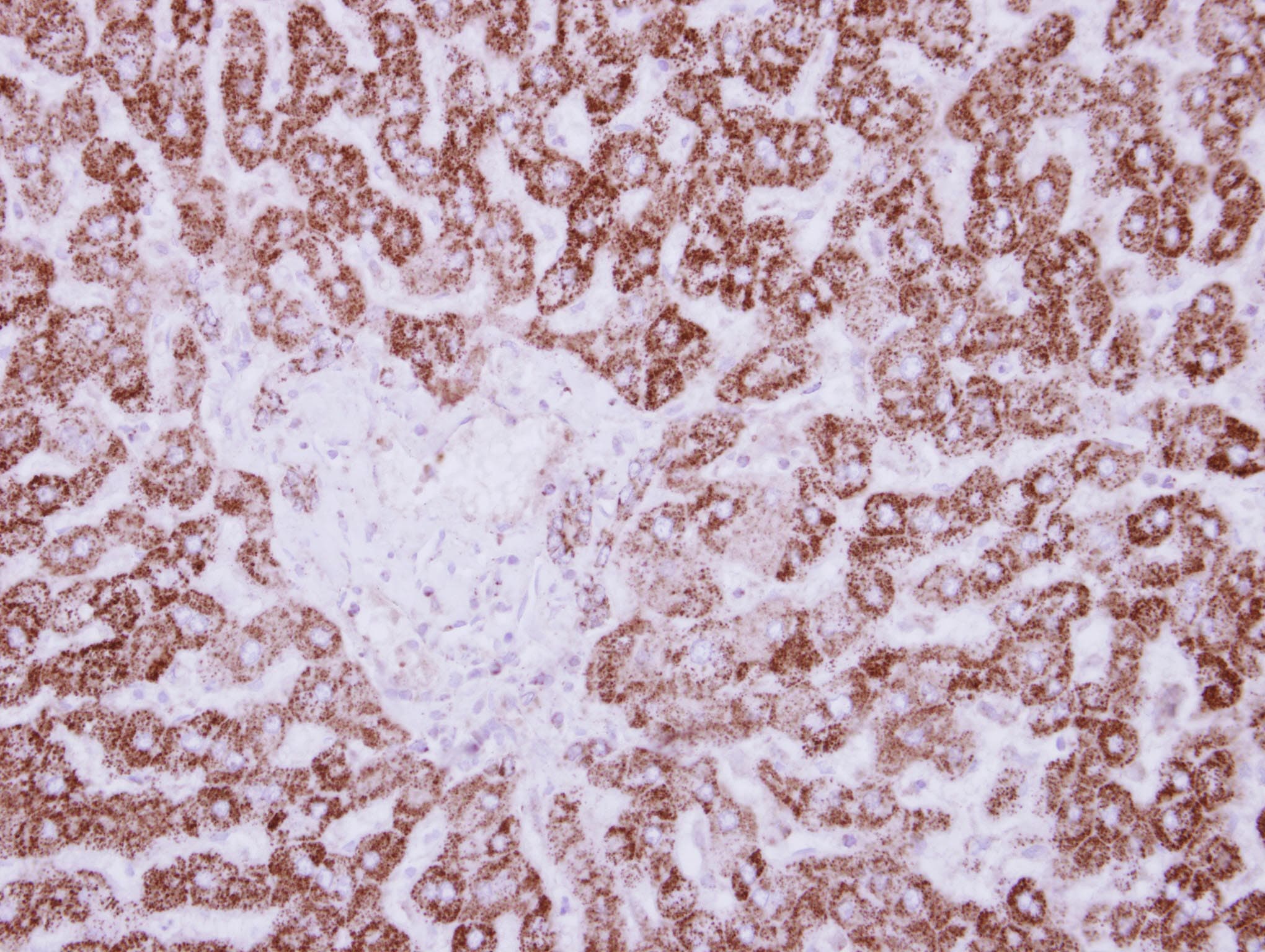 HIBADH Antibody