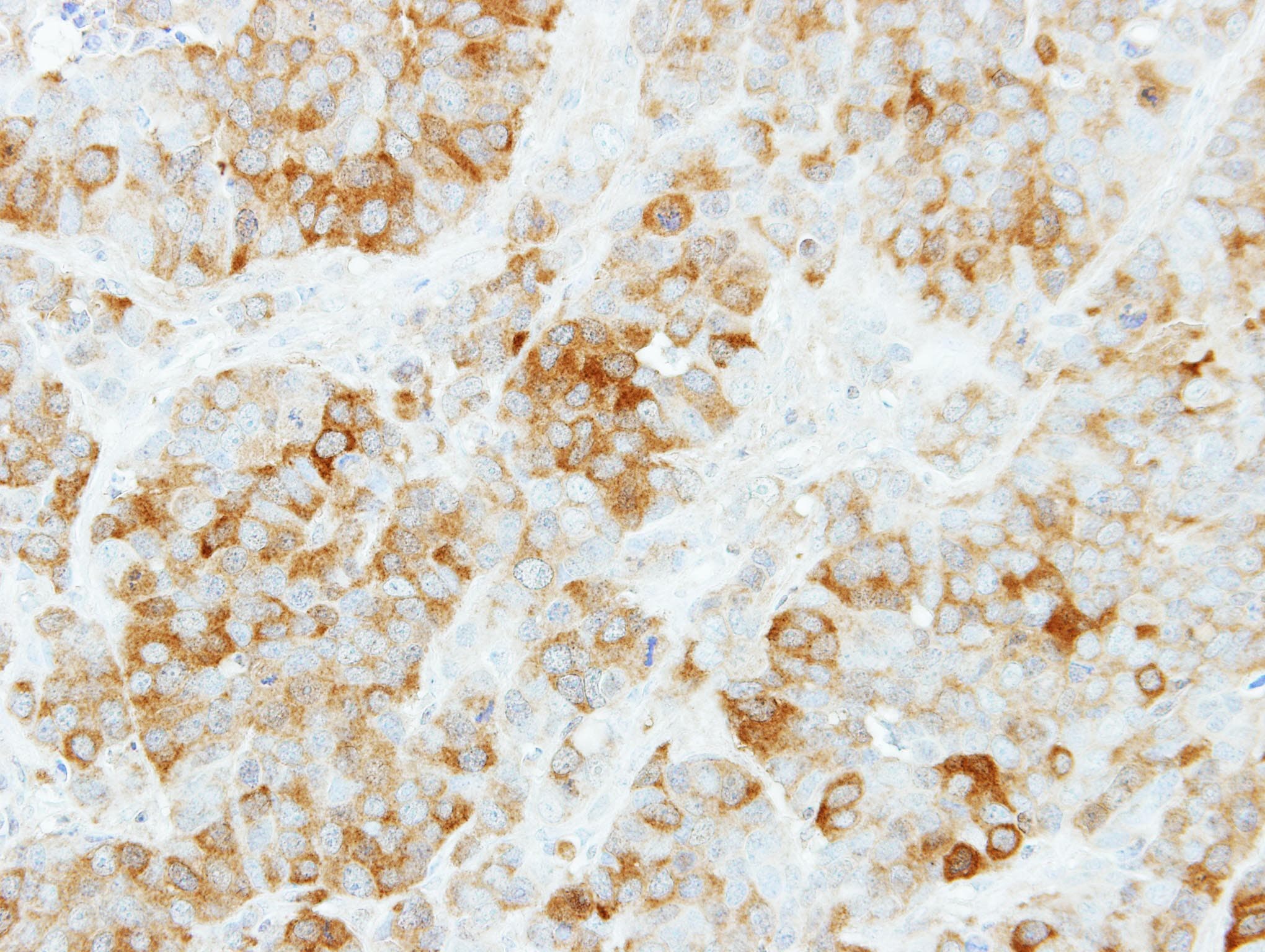 KYNU Antibody (aa114-329)