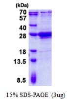 Human AMELX Protein (Recombinant His)