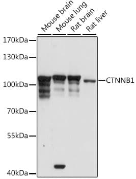 Polyclonal Rabbit anti-Human CTNNB1 / Beta Catenin Antibody (IHC, WB)
