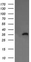 Monoclonal Mouse anti-Human KIF25 Antibody (clone OTI2B4, IF, WB)