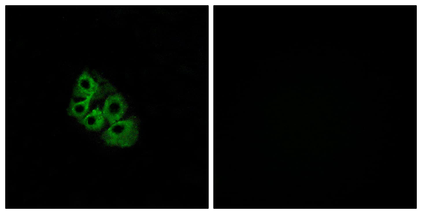 LHCGR / LHR / LH Receptor Antibody (aa621-670)