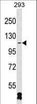 RBM26 / SE70 Antibody (aa196-225)