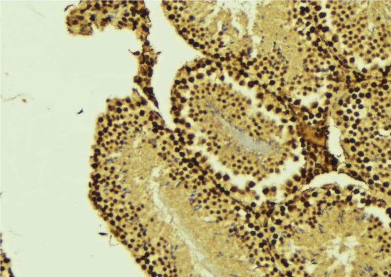 Polyclonal Rabbit anti-Human CARD8 / Cardinal / TUCAN Antibody (IHC, WB)