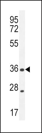 Polyclonal Rabbit anti-Human XCR1 Antibody (aa305-333, WB)