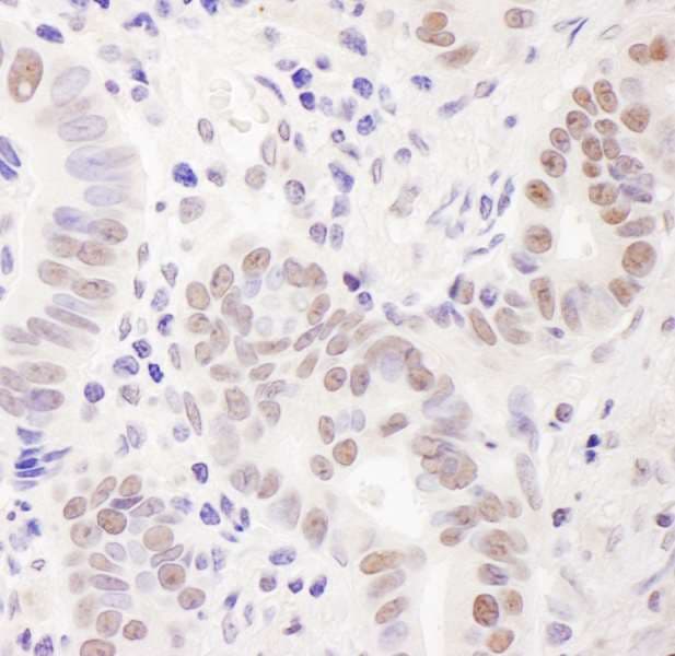C11orf30 / EMSY Antibody (aa1250-C-term)