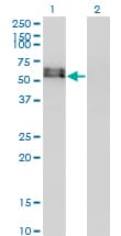 ALK2 / ACVR1 Antibody (clone 2D5)
