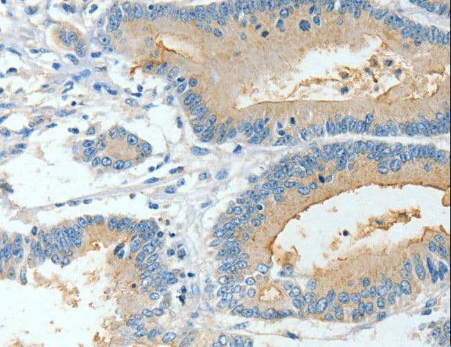 BAAT / BAT Antibody