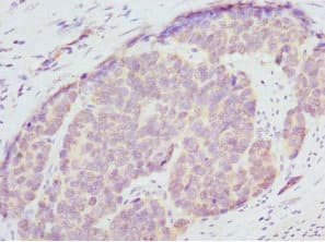 Polyclonal Rabbit anti-Human ENOX2 Antibody (IHC)