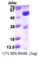 Human ACADL Protein (Recombinant His)