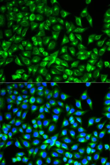 IHC-plus™ Polyclonal Rabbit anti-Human CDC34 Antibody (IHC, IF, WB)