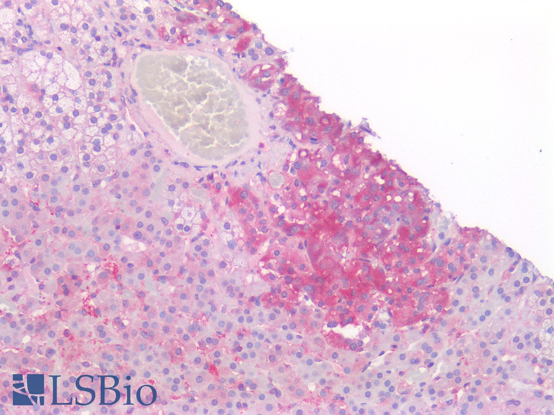IHC-plus™ Polyclonal Rabbit anti-Human OCLN / Occludin Antibody (IHC)