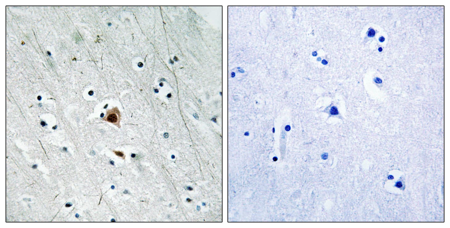 MAPKAPK2 / MAPKAP Kinase 2 Antibody (phospho-Ser272)