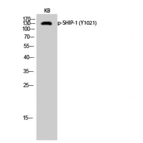 INPP5D / SHIP1 / SHIP Antibody (960-1040 aa)