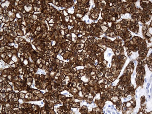 VIL1 / Villin Antibody (aa1-188, clone UMAB230)