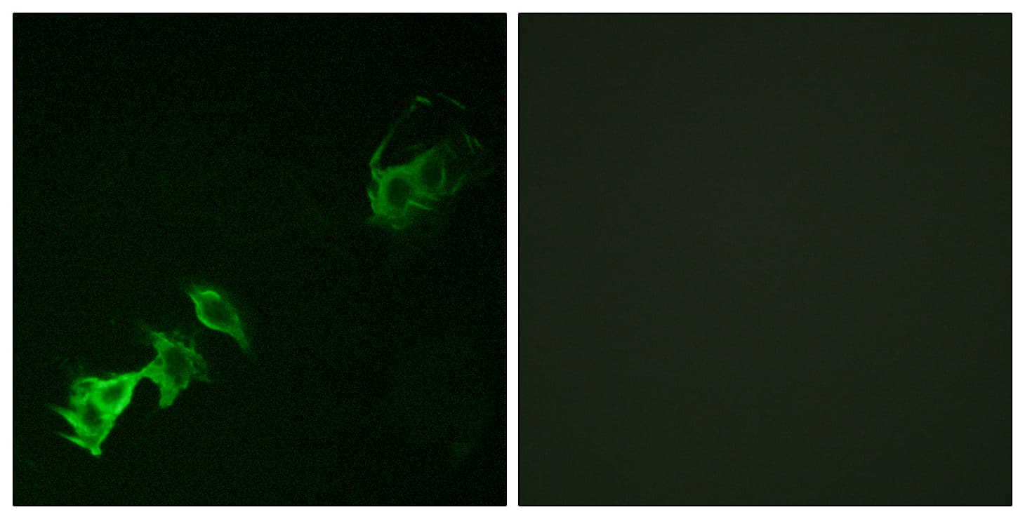 ABL Antibody (phospho-Tyr393)