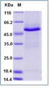 Human TRIM21 / RO52 Protein (Recombinant His,N-terminus)