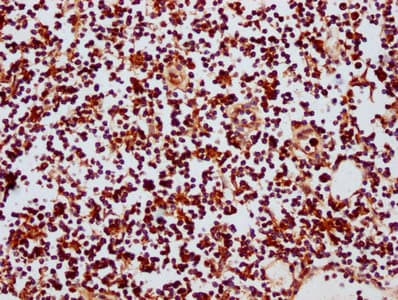 GATAD2B Antibody