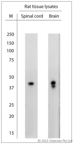 Polyclonal Rabbit anti-Human NeuN Antibody (aa80-130, IHC, WB)
