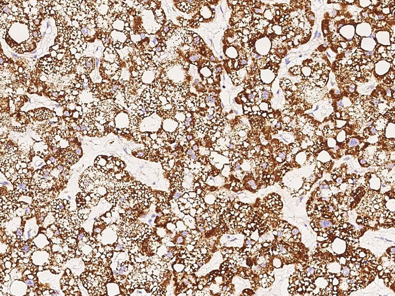 GOT2 Antibody (Preservative Free)