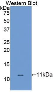 SLC6A3 / Dopamine Transporter Antibody (aa562-619)