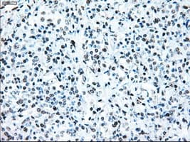 BRAF / B-Raf Antibody (clone OTI4C5)