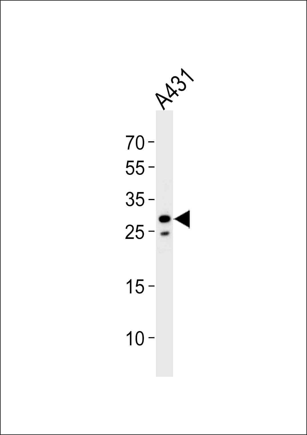 RNF208 Antibody (aa86-115)