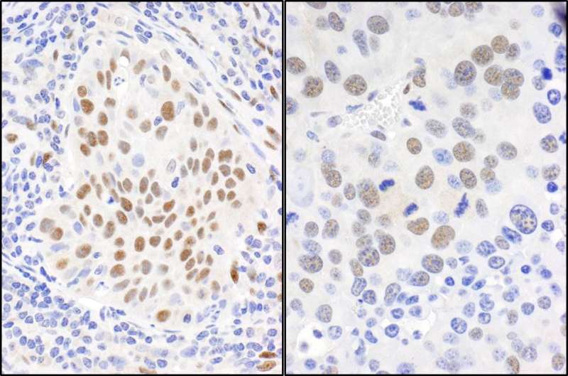 RBFOX2 / RBM9 Antibody (aa1-50)