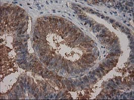 15-PGDH / HPGD Antibody (clone OTI1C10)