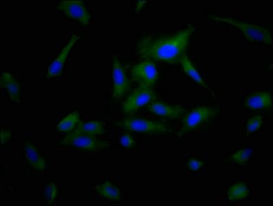 Polyclonal Rabbit anti-Human POPDC3 Antibody (IF)