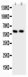 Polyclonal Rabbit anti-Human SRC Antibody (aa2-368, IHC, WB)